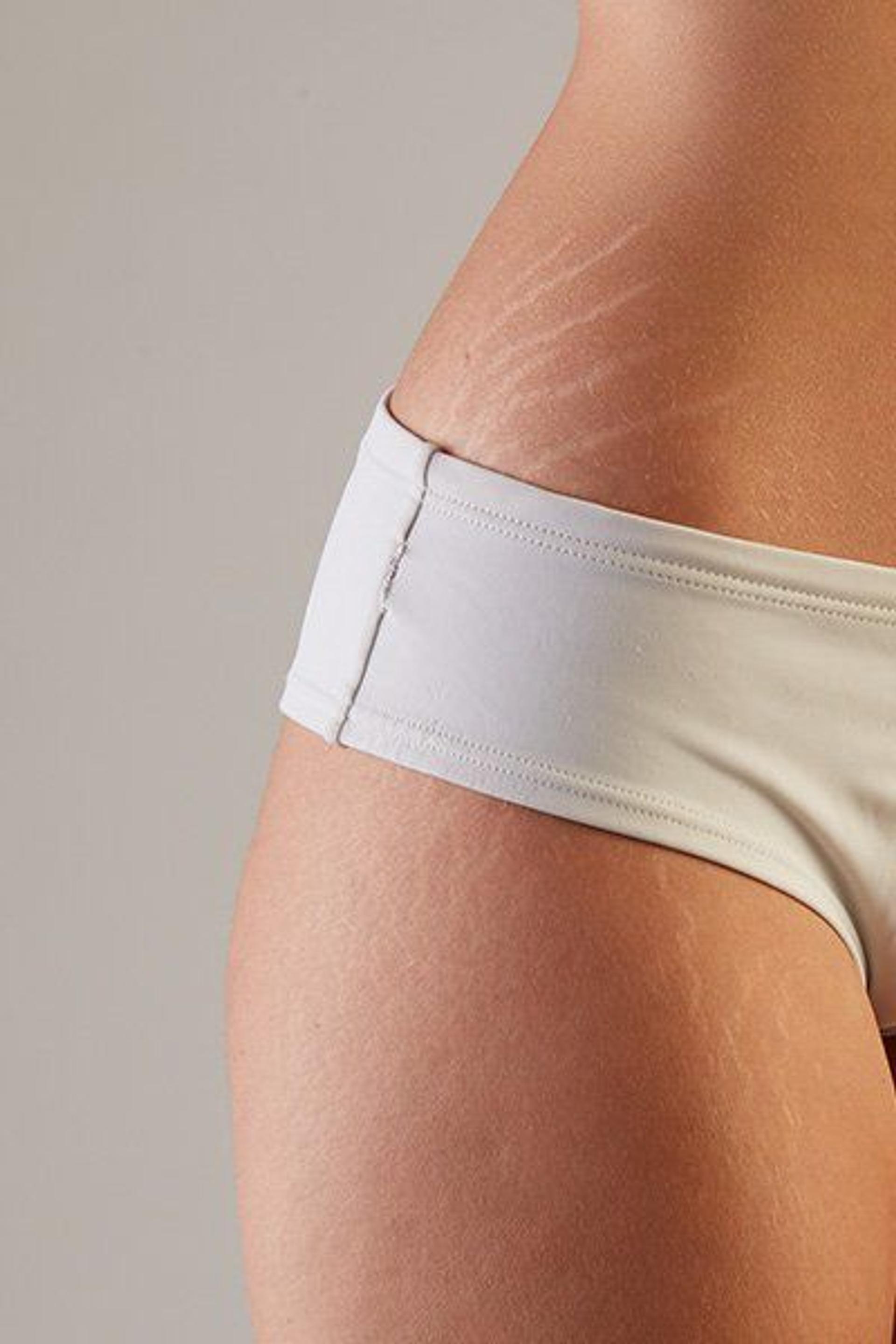 Stretch Mark & Scar Repair