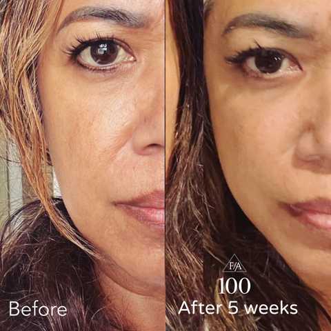 gallery image in our gallery