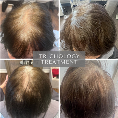 gallery image in our gallery