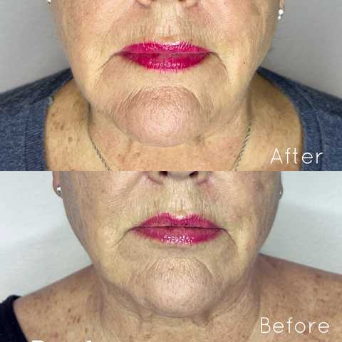 gallery image in our gallery