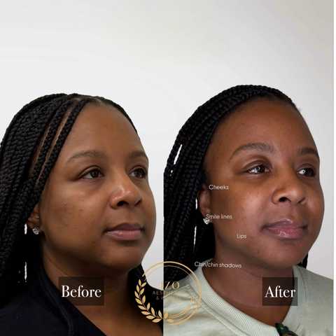 gallery image in our gallery