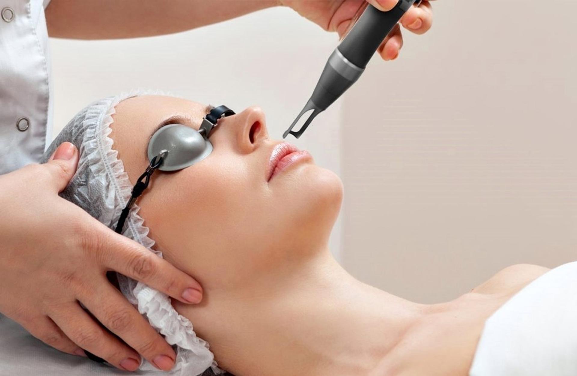 Cold Plasma (Laser Facials)