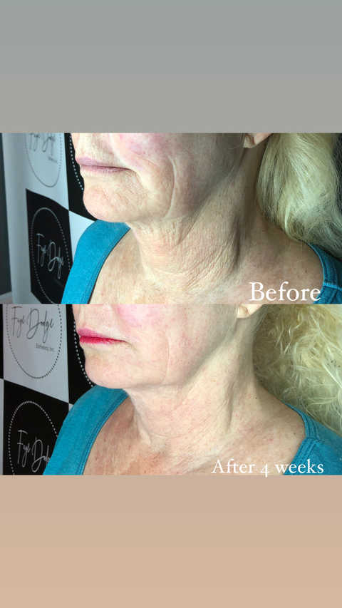 gallery image in our gallery