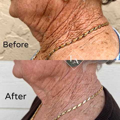 gallery image in our gallery