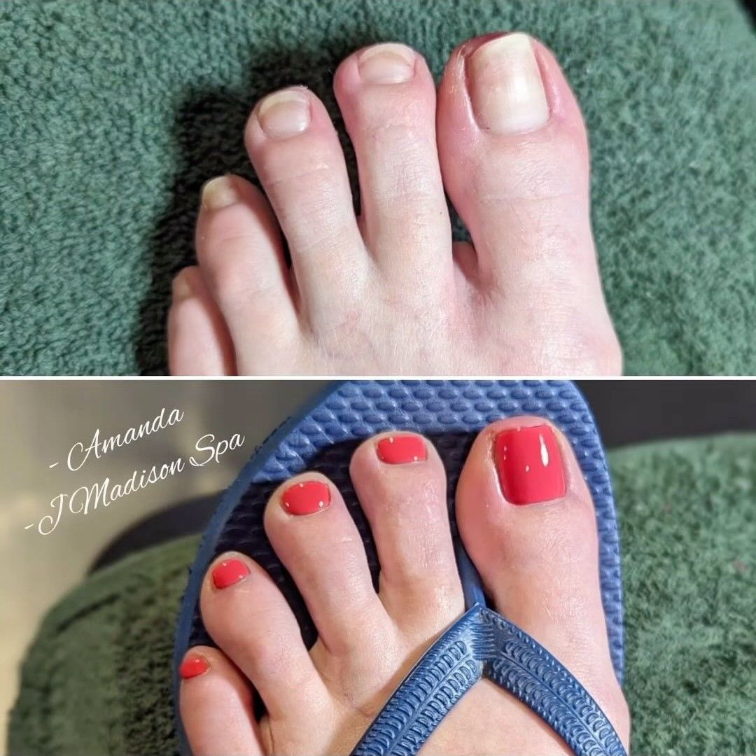 Pedicure