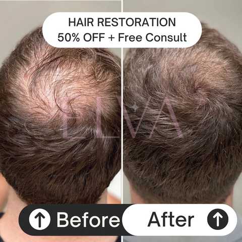 gallery image in our gallery