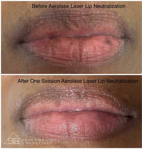 gallery image in our gallery