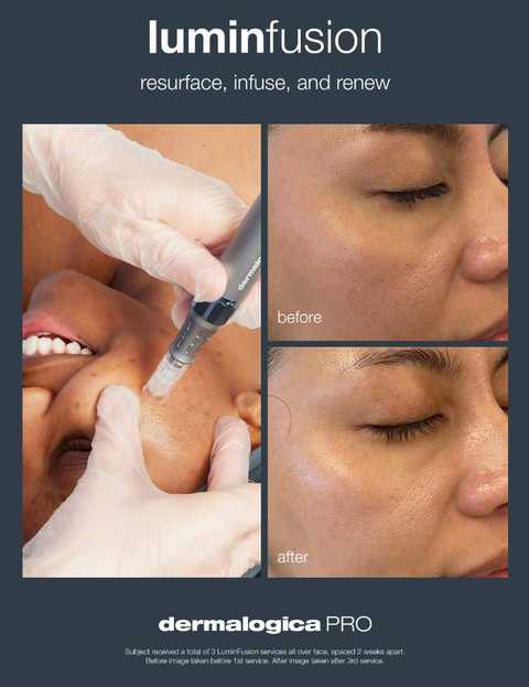 gallery image in our gallery