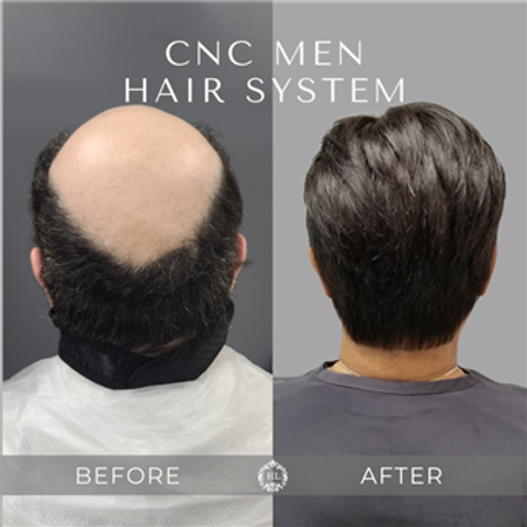 gallery image in our gallery