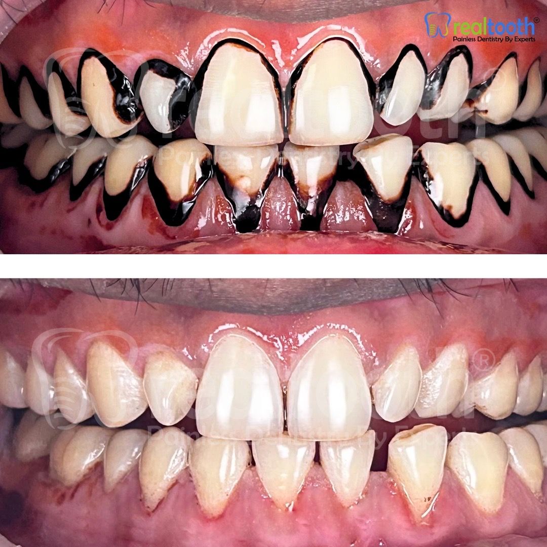  dental,teeth,before-after,health,clinic  