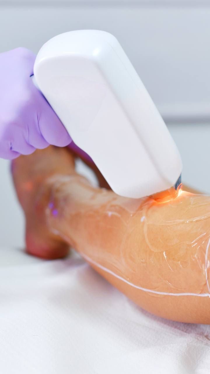 Laser Hair Reduction