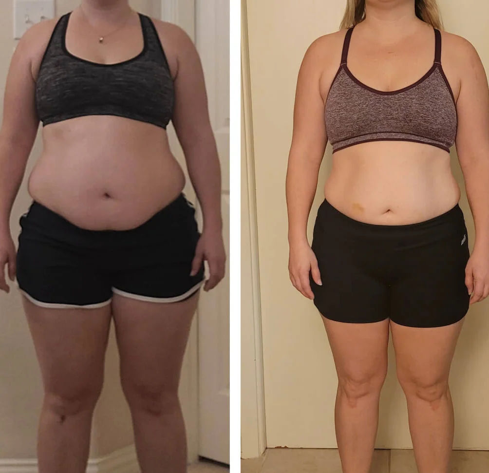 Body Contouring