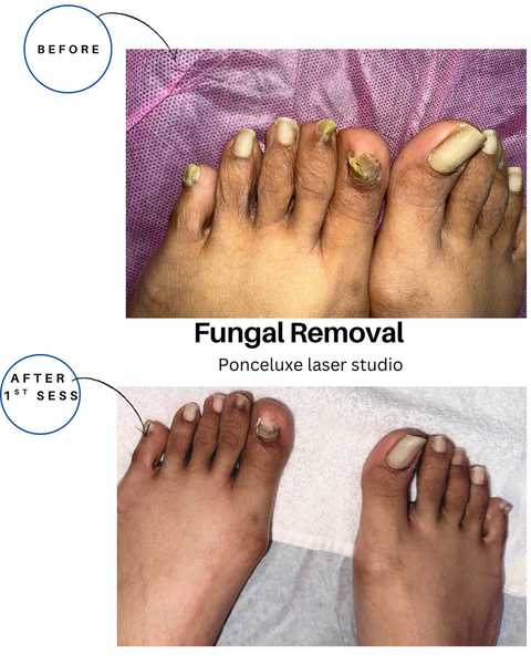 gallery image in our gallery