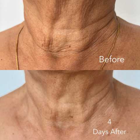 gallery image in our gallery