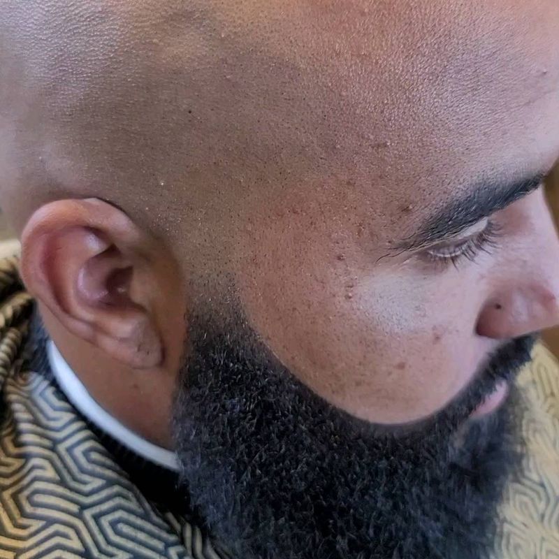 Bald Head