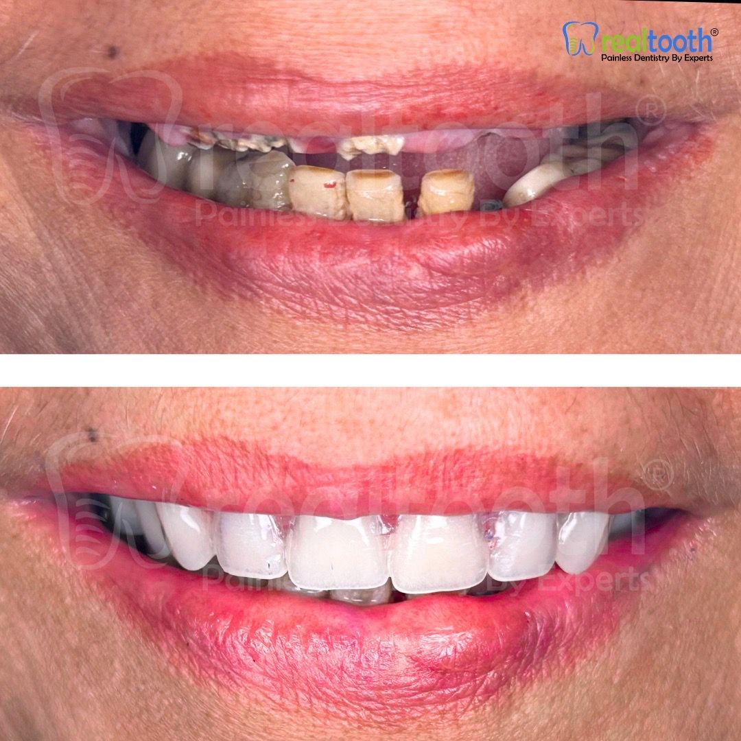  dental,smile,transformation,teeth,before-after,healthcare 