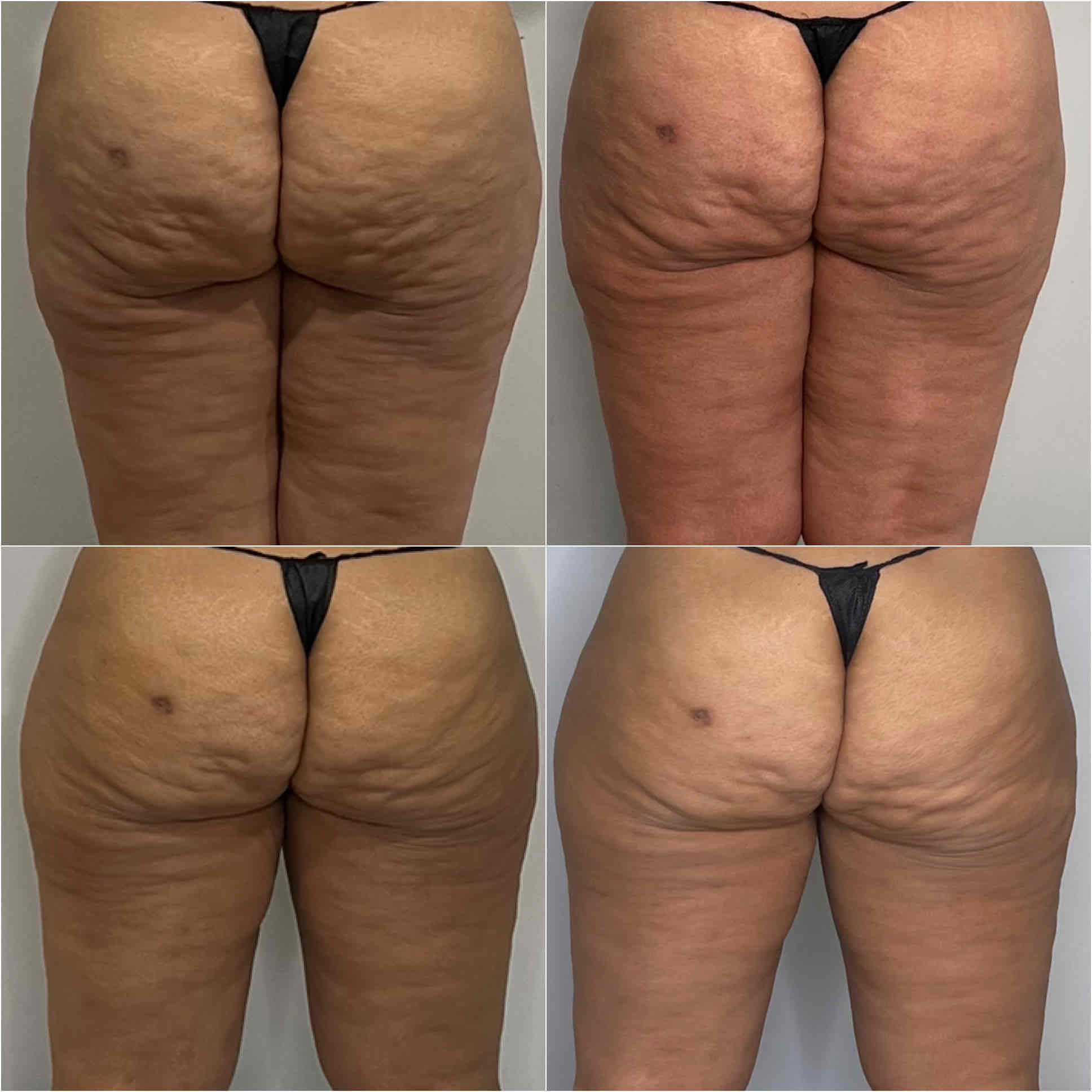 before and after,transformation,skin treatment,spa service  