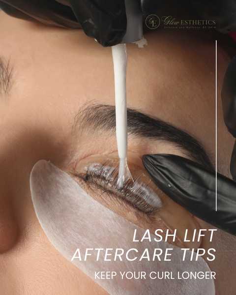 gallery image in our gallery