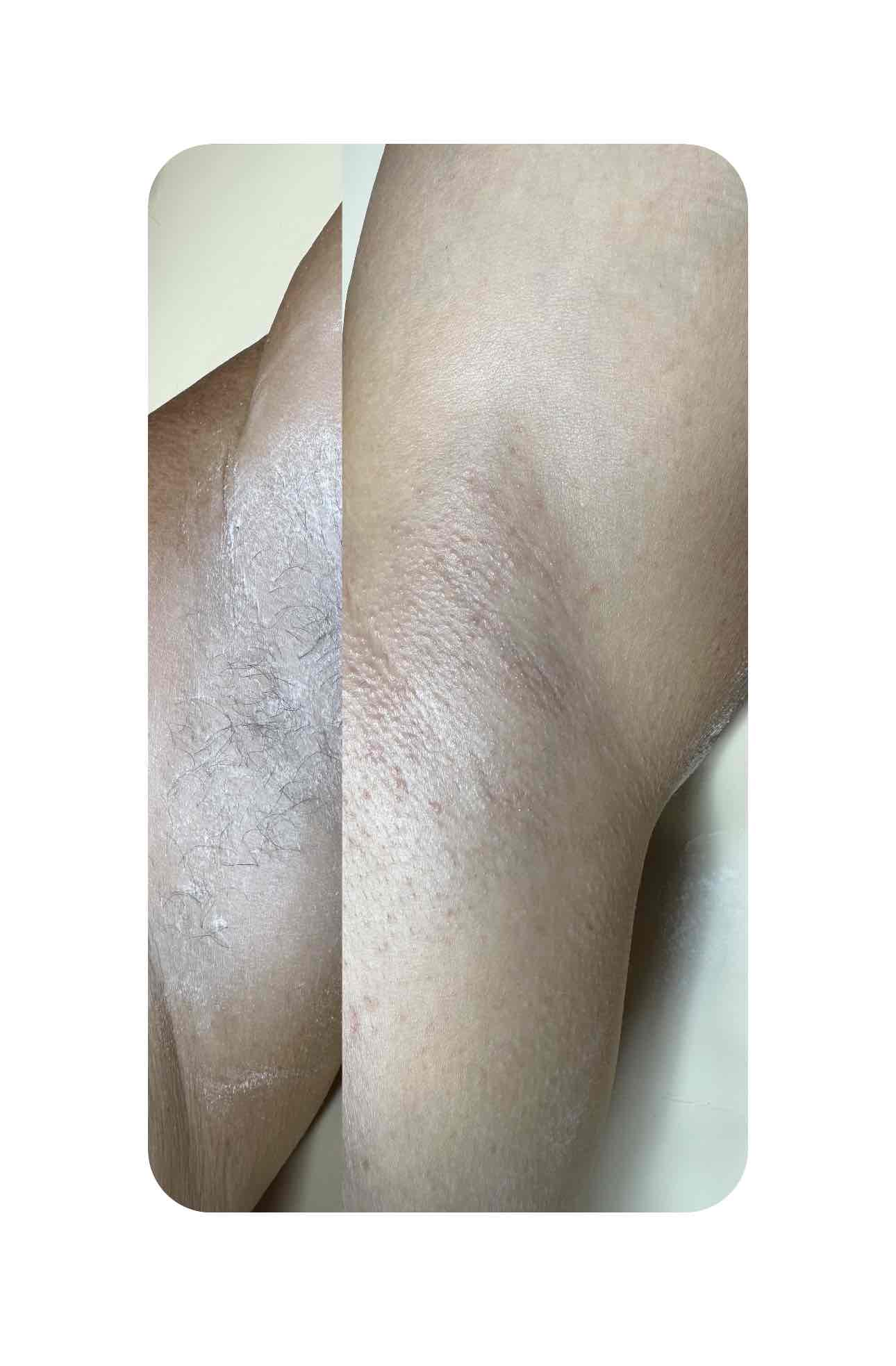  skin,care,before-after,comparison,transformation,beauty 