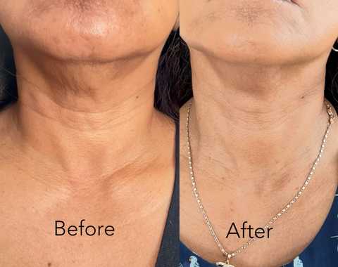 gallery image in our gallery