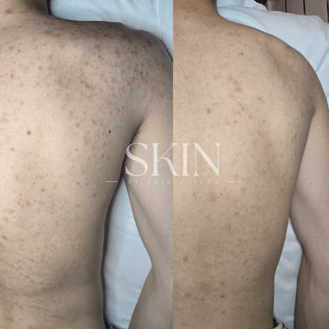 Body Treatments service