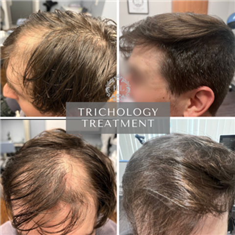 gallery image in our gallery