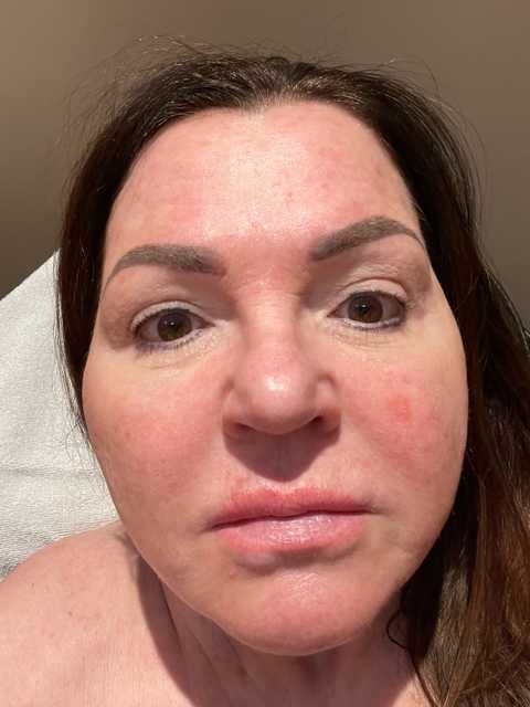 gallery image in our gallery