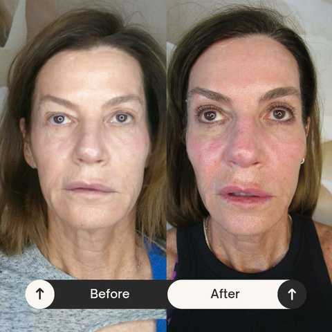 gallery image in our gallery