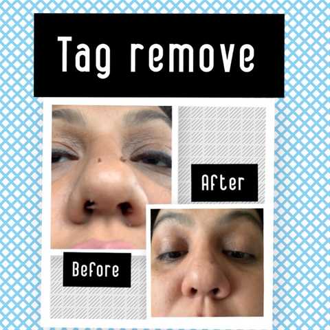 gallery image in our gallery