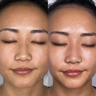  before-after,facial-treatment,beauty,skincare,glow 