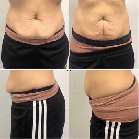 gallery image in our gallery