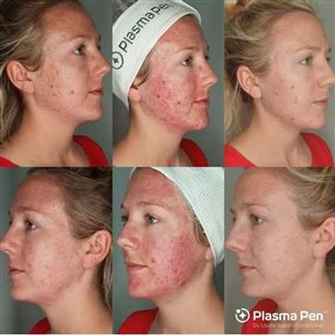 gallery image in our gallery