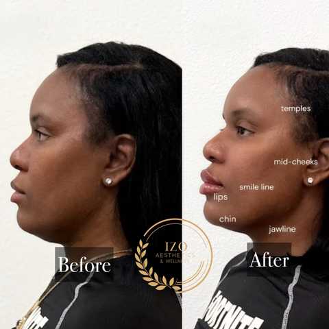 gallery image in our gallery