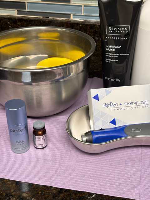 Microneedling W/ Exosomes - Classic