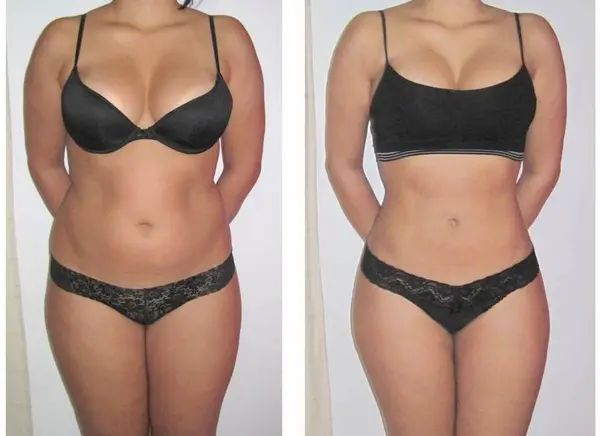  before-and-after,body-transformation,fitness,wellness 