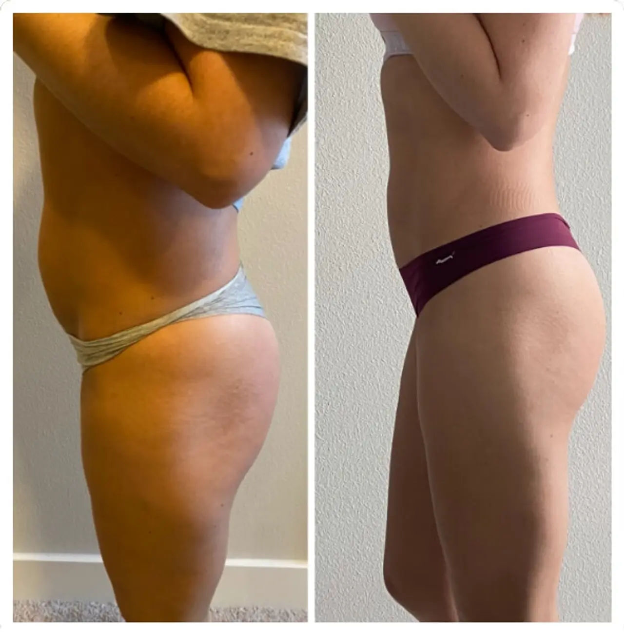  before-and-after,body-transformation,fitness 