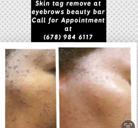 gallery image in our gallery