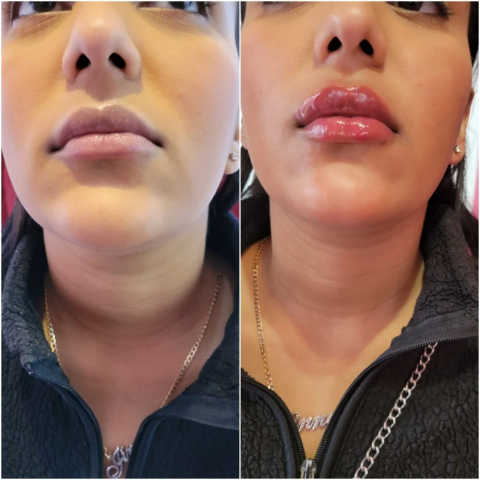 gallery image in our gallery