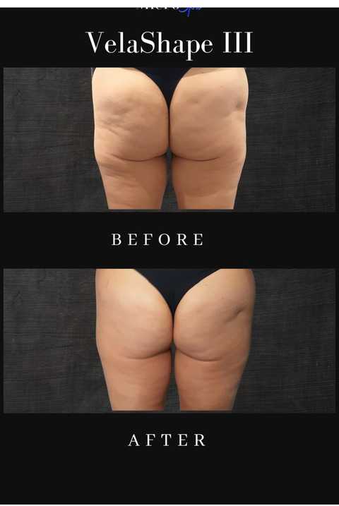 gallery image in our gallery