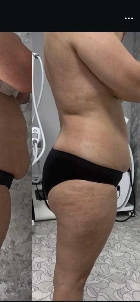 gallery image in our gallery