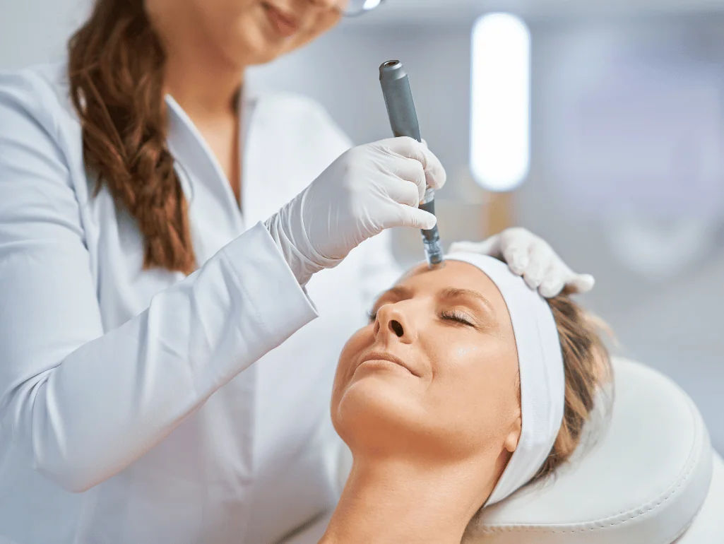 Microneedling