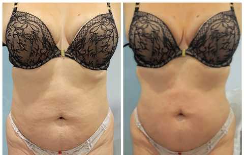 gallery image in our gallery