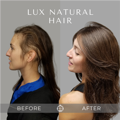 gallery image in our gallery