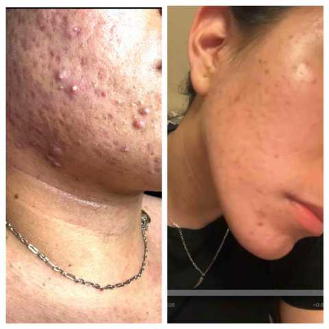 gallery image in our gallery