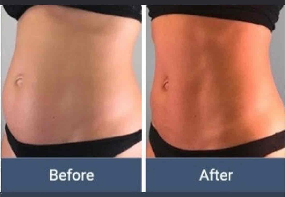  before-after,body,fitness,transformation  