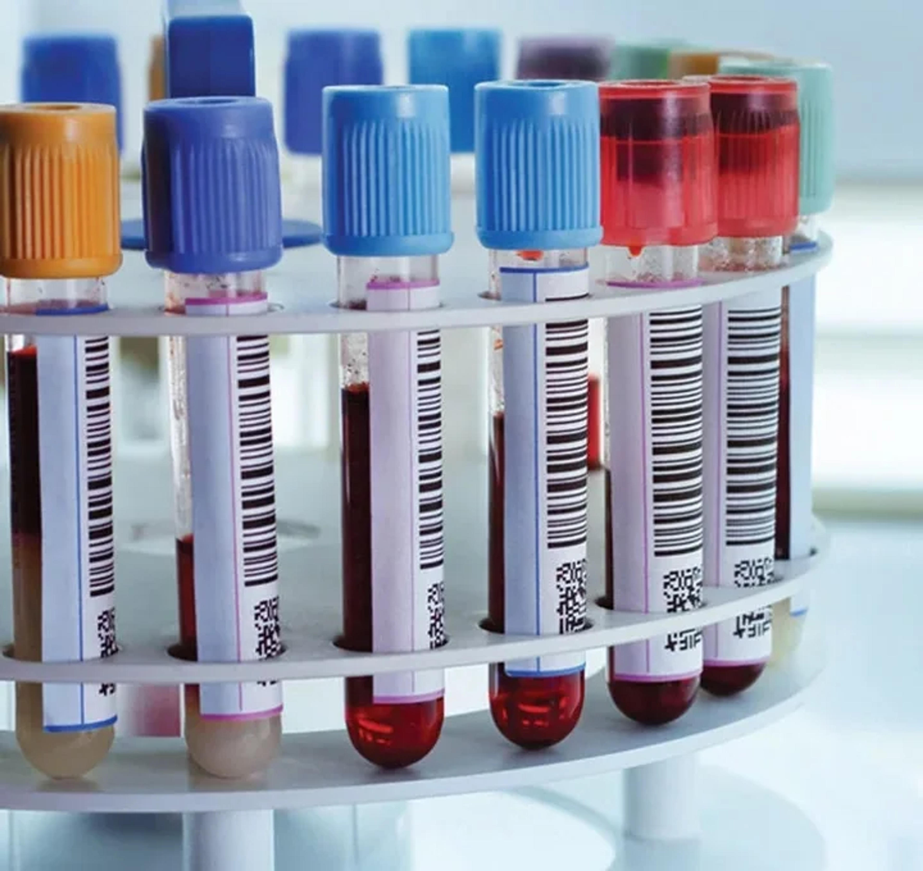 Fungal Testing