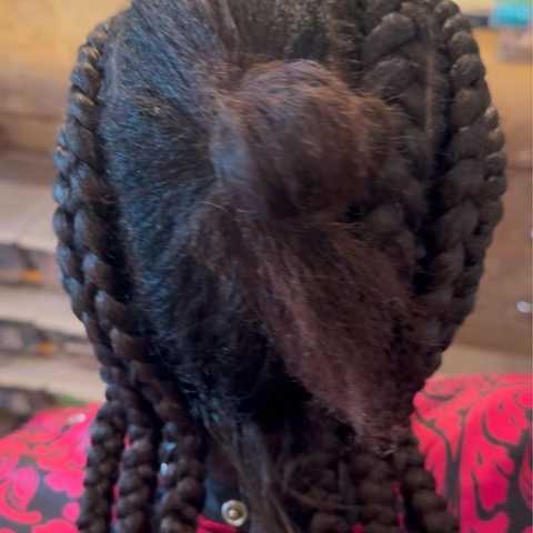 Hair Removal service