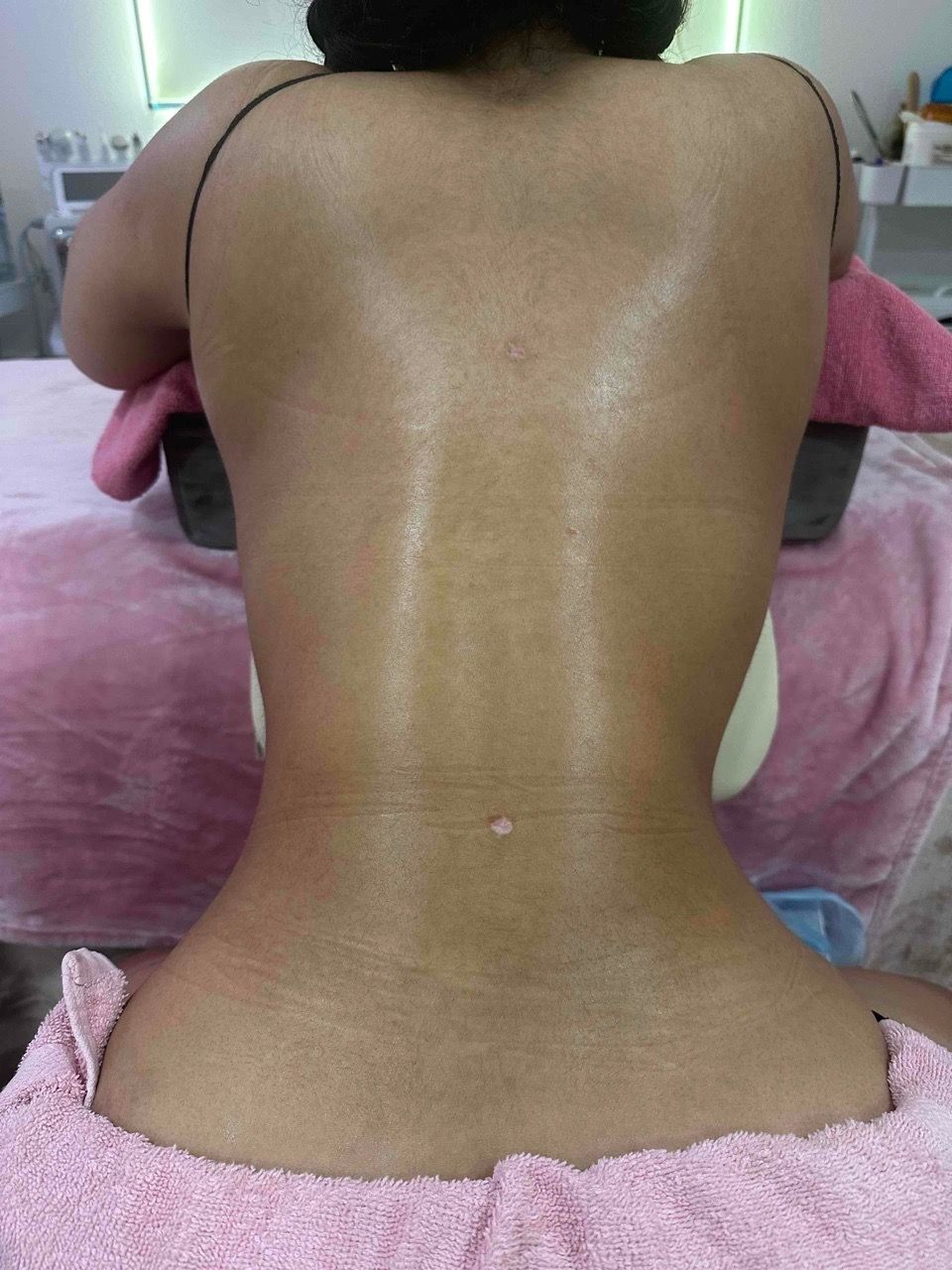 Post Operative Care