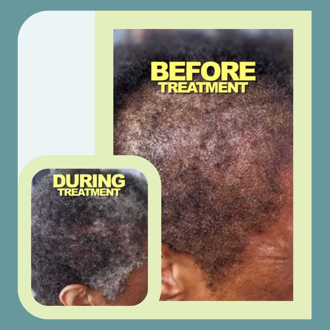 1 Premium Locs and PRP suite in Brooklyn NYC | SimpleStyles by Mel