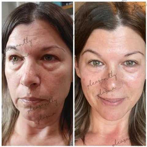 gallery image in our gallery